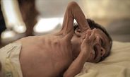 Около 1000 детей скончалось от кори в Бангладеш